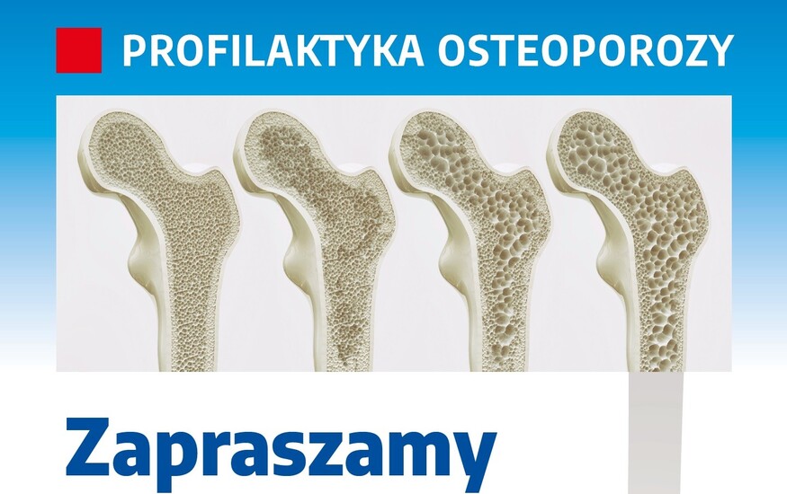 Ogólnopolska akcja &#039;&#039;Mocne kości do starości&#039;&#039;...